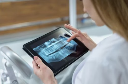 Radiografía digital